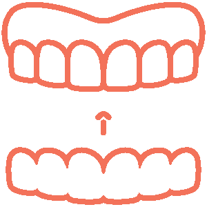 Clear Aligners